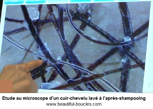 Cuir-chevelu microscope méthode no poo